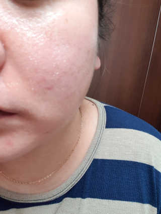 비알티씨 안티폴루션 퍼펙트 카밍 클렌징 오일 — 5점을 준 리뷰어가 2019년 3월 올린 사용 사진