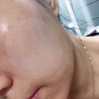 자이엘 S.O.S 레드 칙 케어팩 2 Box — 5점을 준 리뷰어가 2019년 10월 올린 사용 사진