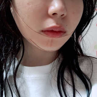 아이디플라코스메틱 아이디 페이스핏 마이너스 밴드 — 4.5점을 준 리뷰어가 2019년 12월 올린 사용 사진