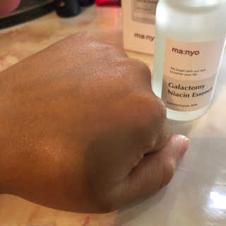 [마녀 공장] 발가락 토미 니아신 에센스 50ml — 5점을 준 리뷰어가 2019년 6월 올린 사용 사진
