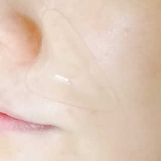 아이디플라코스메틱 아이디 페이스핏 플러스 패치 — 4점을 준 리뷰어가 2019년 10월 올린 사용 사진