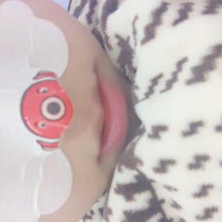 나이팅게일 TAKO PACK NOSE [문어코팩] — 3.5점을 준 리뷰어가 2016년 12월 올린 사용 사진