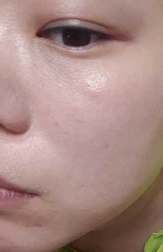 쏘내추럴 리얼 매트 세팅 픽서 — 2점을 준 리뷰어가 2019년 7월 올린 사용 사진