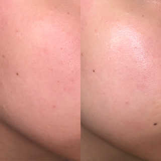 [스킨큐어] 산다화 비타민C 화이트닝 에센스 30ml — 4.5점을 준 리뷰어가 2020년 3월 올린 사용 사진