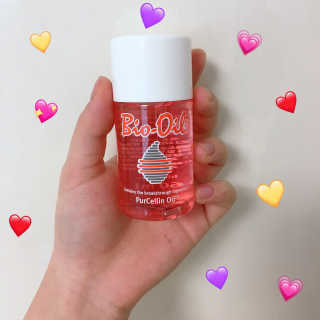 Bio-oil(바이오오일) 바이오오일(Bio-oil) — 5점을 준 리뷰어가 2017년 1월 올린 사용 사진