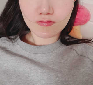 아이디플라코스메틱 아이디 페이스핏 마이너스 밴드 — 4점을 준 리뷰어가 2019년 12월 올린 사용 사진