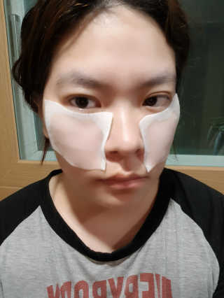 토모토끼 아이메이징 앰플 트리트먼트 스페셜 세트 — 5점을 준 리뷰어가 2019년 10월 올린 사용 사진