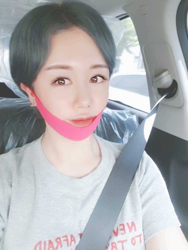 스케덤 펩타이드 리프팅밴드 리뷰 사진