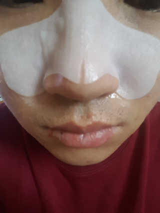 나이팅게일 TAKO PACK NOSE [문어코팩] — 5점을 준 리뷰어가 2017년 6월 올린 사용 사진