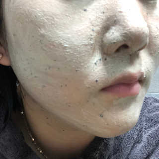 글랜무어 디톡 제올라이트 클리어링 버블 팩 — 3점을 준 리뷰어가 2019년 12월 올린 사용 사진