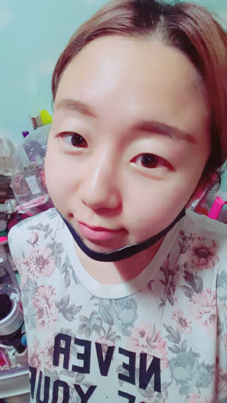어웨이크어슬립 어슬립 페이스 리프트업 밴드 — 4.83점을 준 리뷰어가 2018년 5월 올린 사용 사진