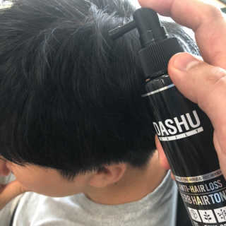 다슈코리아 다슈 데일리 안티 헤어로스 허브 헤어토닉 150ml — 5점을 준 리뷰어가 2019년 8월 올린 사용 사진