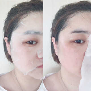 하루앤 울트라 인텐시브 페이셜 리세라시카 4-스텝 마스크팩 — 4점을 준 리뷰어가 2018년 6월 올린 사용 사진