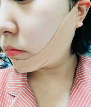 아이디플라코스메틱 아이디 페이스핏 마이너스 밴드 — 4점을 준 리뷰어가 2019년 11월 올린 사용 사진