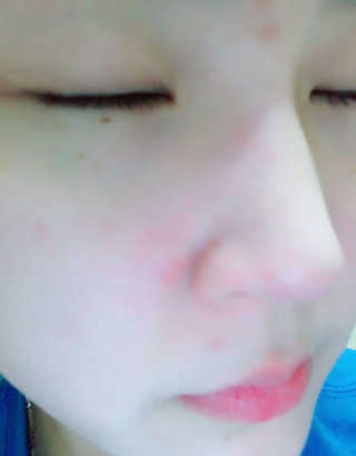 [설레임 코스메틱]블루밍셀 바이탈 프리미엄 솝 — 5점을 준 리뷰어가 2017년 6월 올린 사용 사진