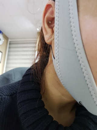 메디미 브이미 업 2스텝 브이라인벨트 — 4.67점을 준 리뷰어가 2017년 12월 올린 사용 사진