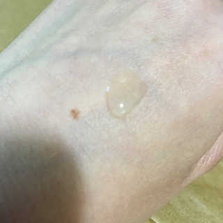 [마녀 공장] 발가락 토미 니아신 에센스 50ml — 4.83점을 준 리뷰어가 2018년 8월 올린 사용 사진