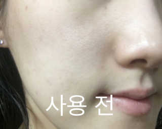 뷰디아니 지친 내 피부를 위한 첫 수분 모이스트 01 토너 — 4.67점을 준 리뷰어가 2018년 5월 올린 사용 사진