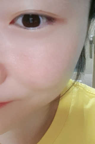 [76N1]딥 화이트닝 마이크로 크림앰플 — 3점을 준 리뷰어가 2019년 12월 올린 사용 사진