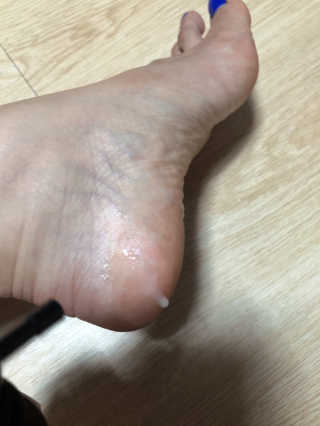 아미니 릴렉싱 풋 필링 스프레이 — 5점을 준 리뷰어가 2019년 8월 올린 사용 사진