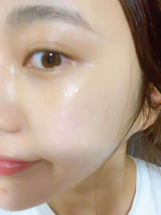 셀리맥스 노니 에너지 앰플 — 5점을 준 리뷰어가 2019년 9월 올린 사용 사진