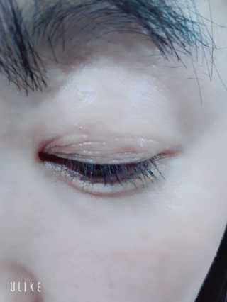 아이크라운 아쿠아 키퍼, 래쉬퀸 — 4.33점을 준 리뷰어가 2018년 12월 올린 사용 사진