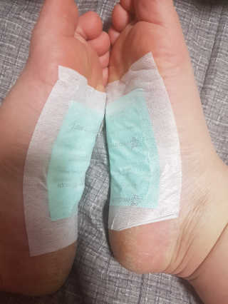 메디테라피 더마 릴렉스 힐링패치 — 5점을 준 리뷰어가 2018년 4월 올린 사용 사진