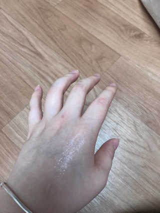 비알티씨 더 퍼스트 앰플 에센스 — 5점을 준 리뷰어가 2019년 4월 올린 사용 사진