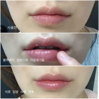 [후르디아] 꿀과즙 보습 립밤_블루베리/석류 3개 세트 — 5점을 준 리뷰어가 2020년 3월 올린 사용 사진