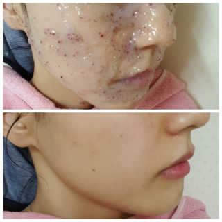 23years old 아쿠아밥 모델링 마스크 — 4점을 준 리뷰어가 2017년 6월 올린 사용 사진