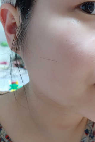 보타니티 [홍]조[진]정[결]케어 플라본 세럼 — 4점을 준 리뷰어가 2018년 5월 올린 사용 사진