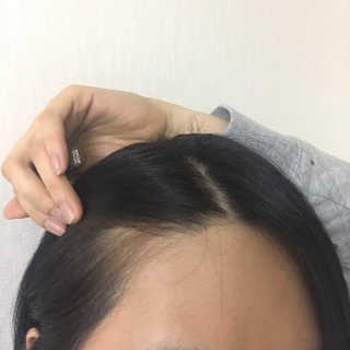 다슈코리아 다슈 데일리 헤어라인 커버 쿠션 — 4점을 준 리뷰어가 2017년 5월 올린 사용 사진