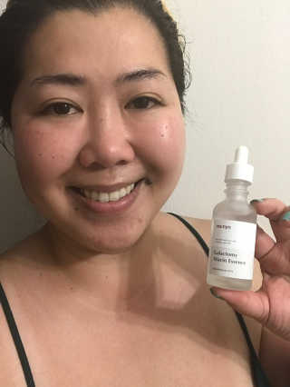 [마녀 공장] 발가락 토미 니아신 에센스 50ml — 5점을 준 리뷰어가 2019년 4월 올린 사용 사진