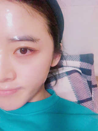 [더마허브] 주사팩 5종, 물광,백옥,태반,신데렐라 등 — 4.33점을 준 리뷰어가 2018년 3월 올린 사용 사진