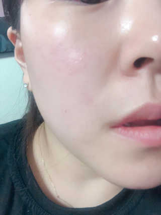 비알티씨 V10 파우더 클렌징 티백 2종 — 4점을 준 리뷰어가 2019년 2월 올린 사용 사진