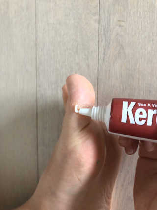 케라셀 풋크림 케라셀 인텐시브 풋 리페어 — 5점을 준 리뷰어가 2019년 10월 올린 사용 사진