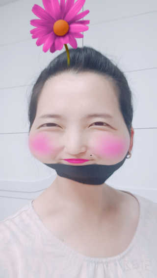 어웨이크어슬립 어슬립 페이스 리프트업 밴드 — 3.67점을 준 리뷰어가 2018년 6월 올린 사용 사진