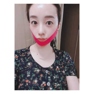 스케덤 펩타이드 리프팅밴드 — 4.5점을 준 리뷰어가 2019년 3월 올린 사용 사진