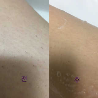 도루코 페이스 [여성용 제모기] 도루코 샤이 크리미 — 4.33점을 준 리뷰어가 2018년 5월 올린 사용 사진