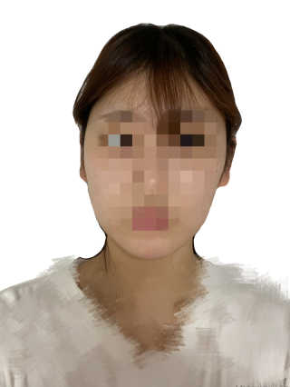 아이디플라코스메틱 아이디 페이스핏 마이너스 밴드 — 5점을 준 리뷰어가 2020년 4월 올린 사용 사진