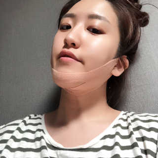 아이디플라코스메틱 아이디 페이스핏 마이너스 밴드 — 2점을 준 리뷰어가 2019년 9월 올린 사용 사진