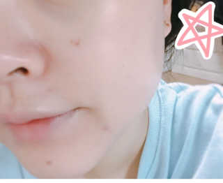 뷰티클로 보태니컬 유브이 쉴드 크림 — 2.5점을 준 리뷰어가 2018년 3월 올린 사용 사진