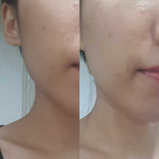 야시엔코 앰플수면팩 퍼플 — 3.5점을 준 리뷰어가 2019년 2월 올린 사용 사진