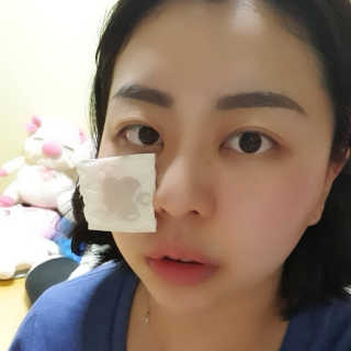 스킨그래머 슈퍼 굿 리페어 에센스 — 4점을 준 리뷰어가 2019년 5월 올린 사용 사진