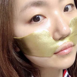 [스케덤] 상악밴드 — 4점을 준 리뷰어가 2019년 6월 올린 사용 사진