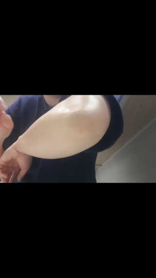 [후르디아] 청포도 매끈약산성 필링 패드_50매 세트 — 5점을 준 리뷰어가 2019년 9월 올린 사용 사진
