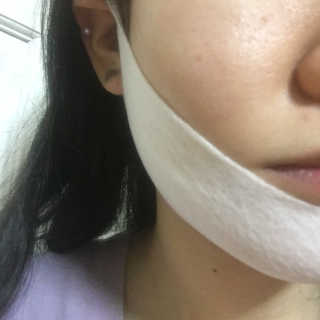 스케덤 클루덤 리프팅 패치 — 3.5점을 준 리뷰어가 2019년 4월 올린 사용 사진
