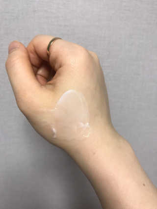 나이팅게일 티타민 크림 리뉴얼 — 5점을 준 리뷰어가 2018년 4월 올린 사용 사진