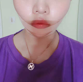 아이디플라코스메틱 아이디 페이스핏 마이너스 밴드 — 5점을 준 리뷰어가 2019년 8월 올린 사용 사진