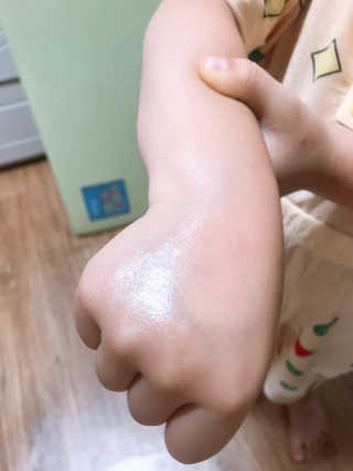 뷰티여우_아토클리닉 [아토클리닉] 아기들이 쓰는 보습, 진정 수딩젤 2개 — 5점을 준 리뷰어가 2019년 7월 올린 사용 사진